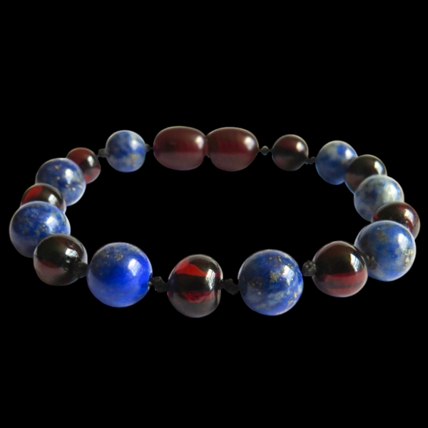 Amber Teething Bracelet / Anklet - Polished Cherry & Lapis Lazuli