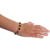 Amber Teething Bracelet / Anklet - Polished Lemon & Cherry Amber